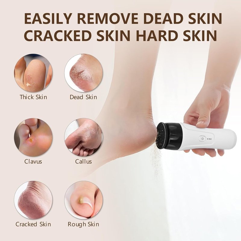 Electric Foot Callus Remover - Rechargeable Pedicure Tool with 2 Grinding Heads | Fast-Acting Foot Sander for Dead Skin