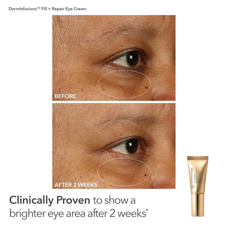Dr. Dennis Gross Fill, Plump & Firm Kit - Hyaluronic Acid Serum, Eye Cream & Lip Treatment | Boost Hydration & Smooth Fine Lines