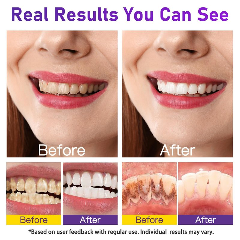 Teeth Whitening Powder - Teeth Whitening - Removes Stains - No Sensitivity - Enamel-Safe Toothpaste Power - Breath Freshener - for Coffee, Tea and Tobacco Stains 10g