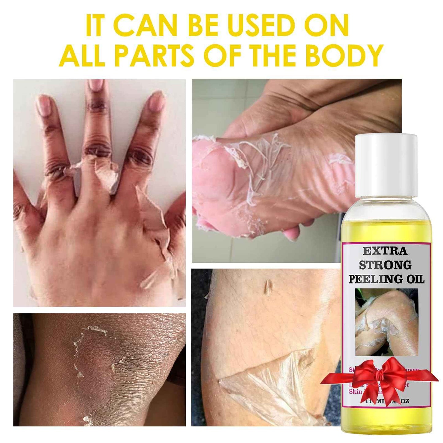 Yellow Peeling Oil Extra Strength Exfoliating Solution for Body - Dark Skin KP Bump Eraser Body Scrub Ingrown Hair Keratosis Pilaris Treatment