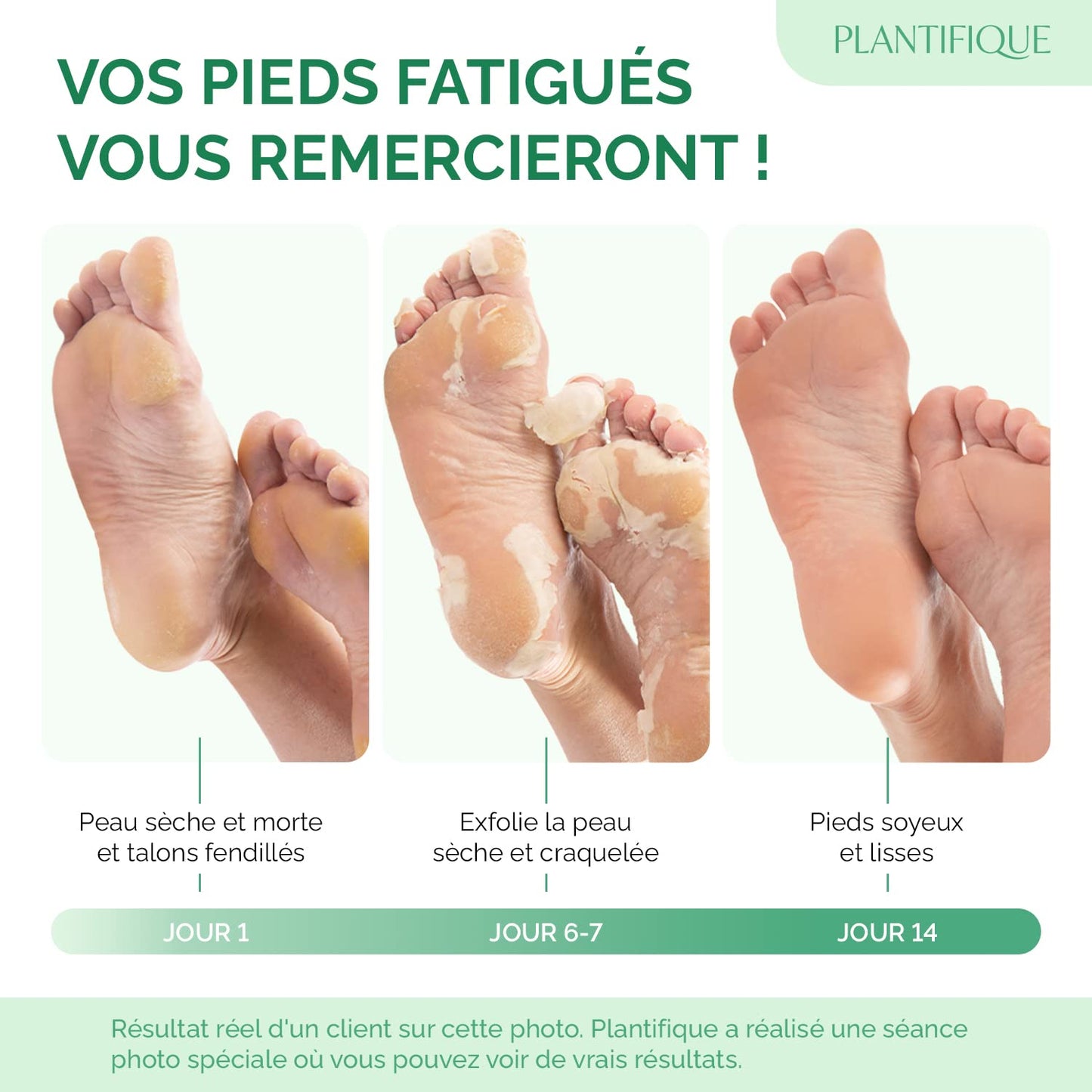 Plantifique Foot Peeling Mask - Exfoliating Clay Mask for Baby Soft Feet | 2 Pack, 110g