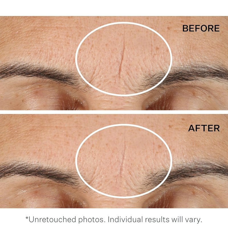 StriVectin Advanced Resurfacing Exfoliating Face Pads - Instant Wrinkle Blurring Primer for Smooth Skin | 30 Pads