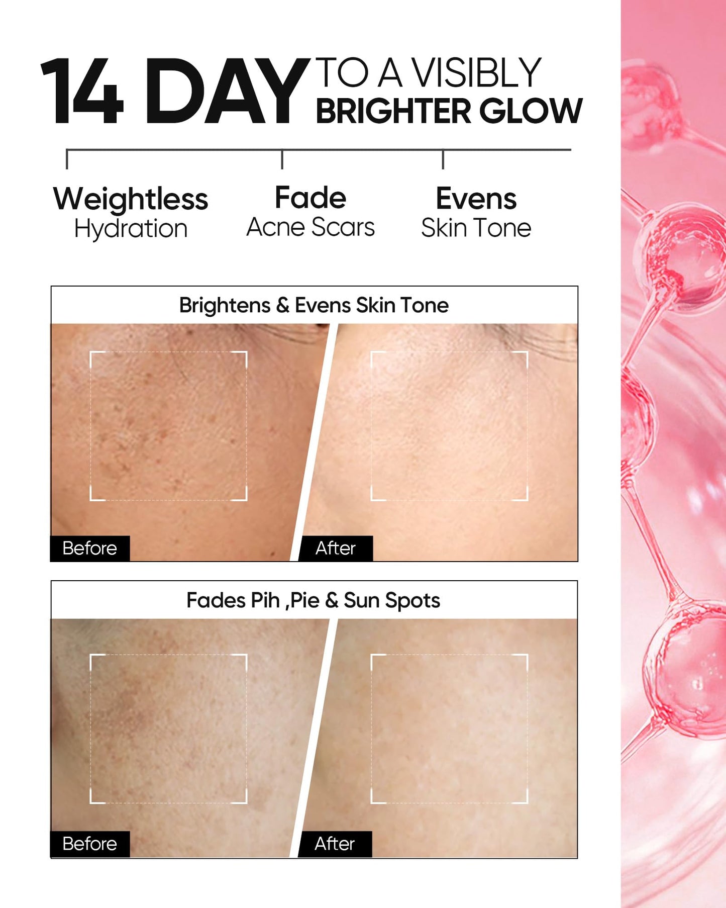 Niacinamide Brightening Cream,Fades Dark Spots, Evens Skin Tone, Tranexamic Acid, α-Arbutin, 5X Ceramides, Centella Asiatica, Suitable for Oil and Acne-prone skin, 2.82 OZ / 80g
