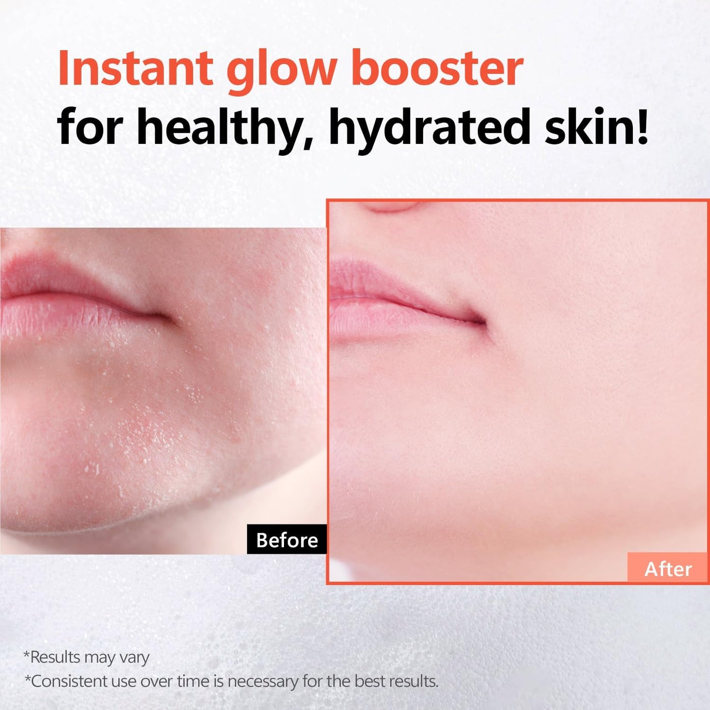Rice Glow Bubble Toner - Milky Hydrating Toner with Niacinamide & Rice Extract | 5.07 fl oz for Sensitive Skin
