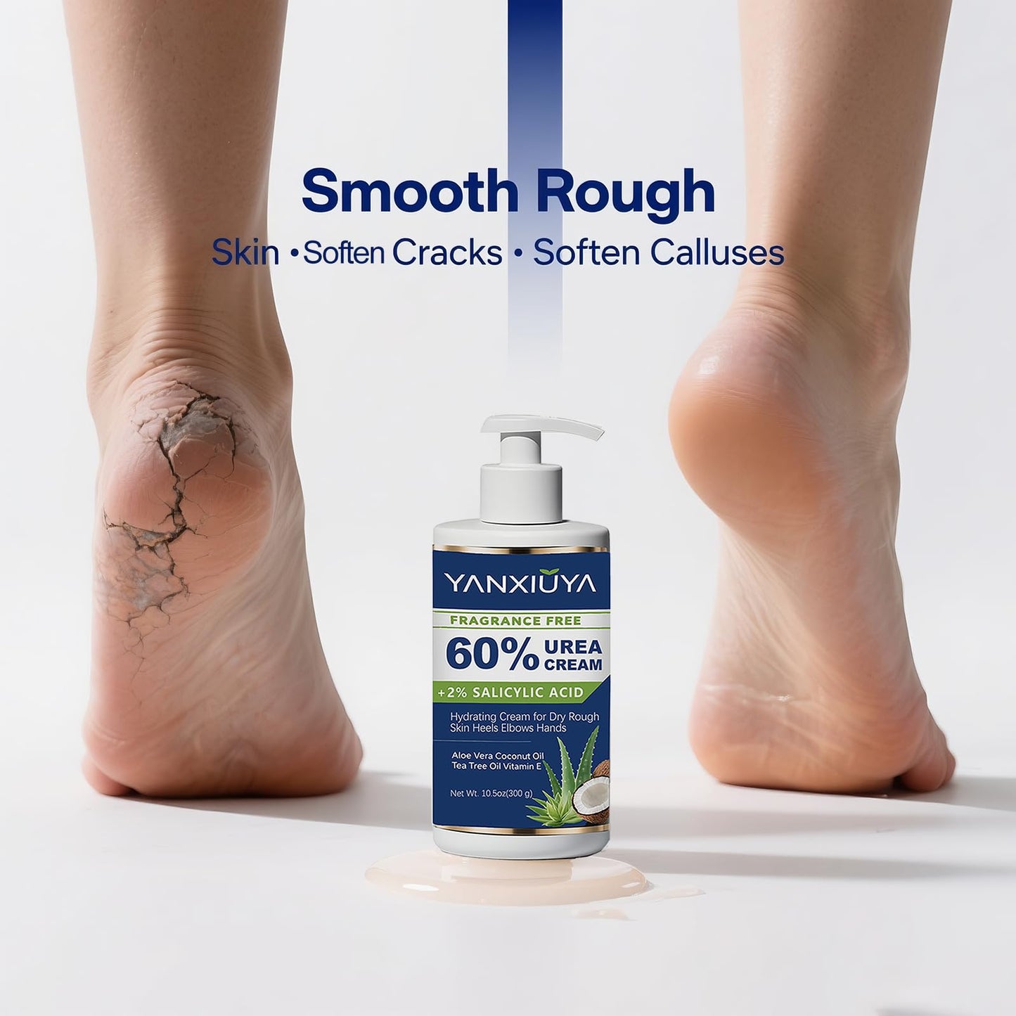 YANXIUYA 60% Urea Cream 10.5 oz, Fragrance-Free Body Lotion with 2% Salicylic Acid, Foot Cream and for Feet, Cracked Heels, Dry Skin & Callus Remover, Maximum Strength Moisturizing Cream