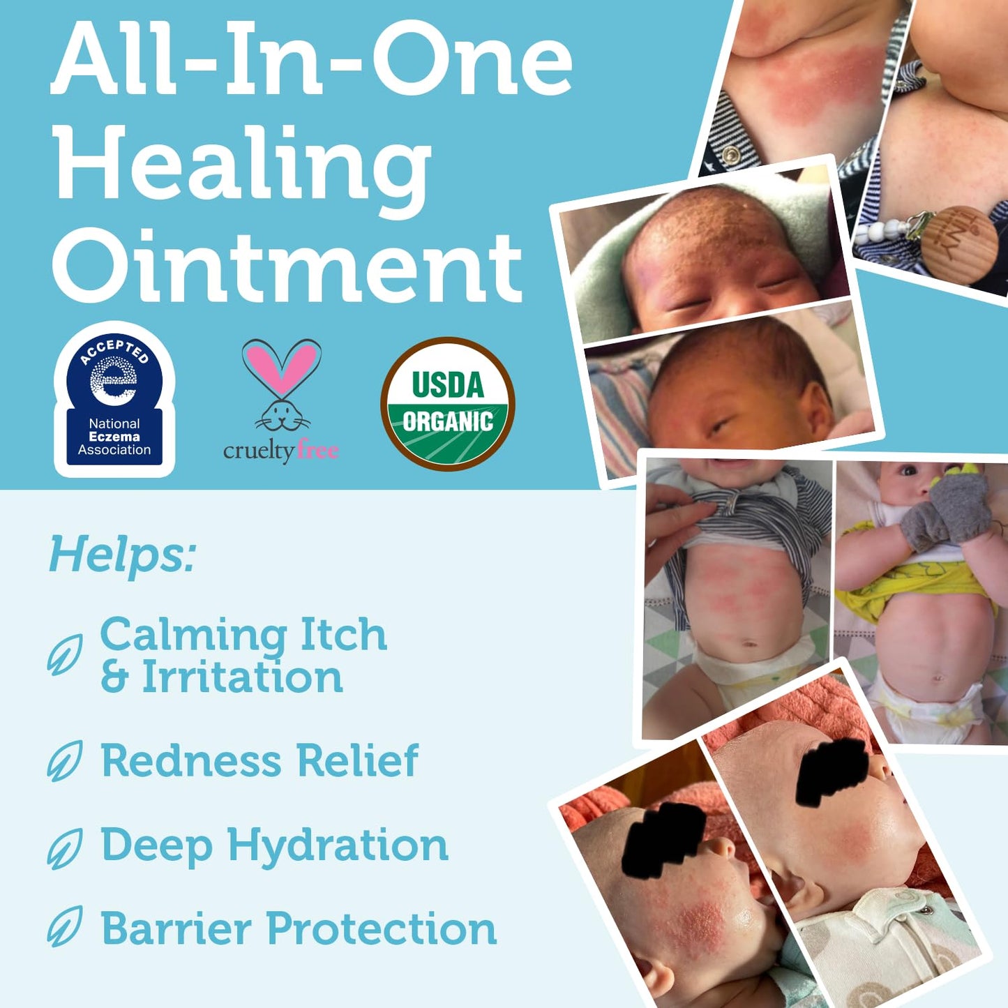 Era Organics Healing Ointment for Babies - Organic Moisturizer for Eczema, Cradle Cap & Rashes | 2oz