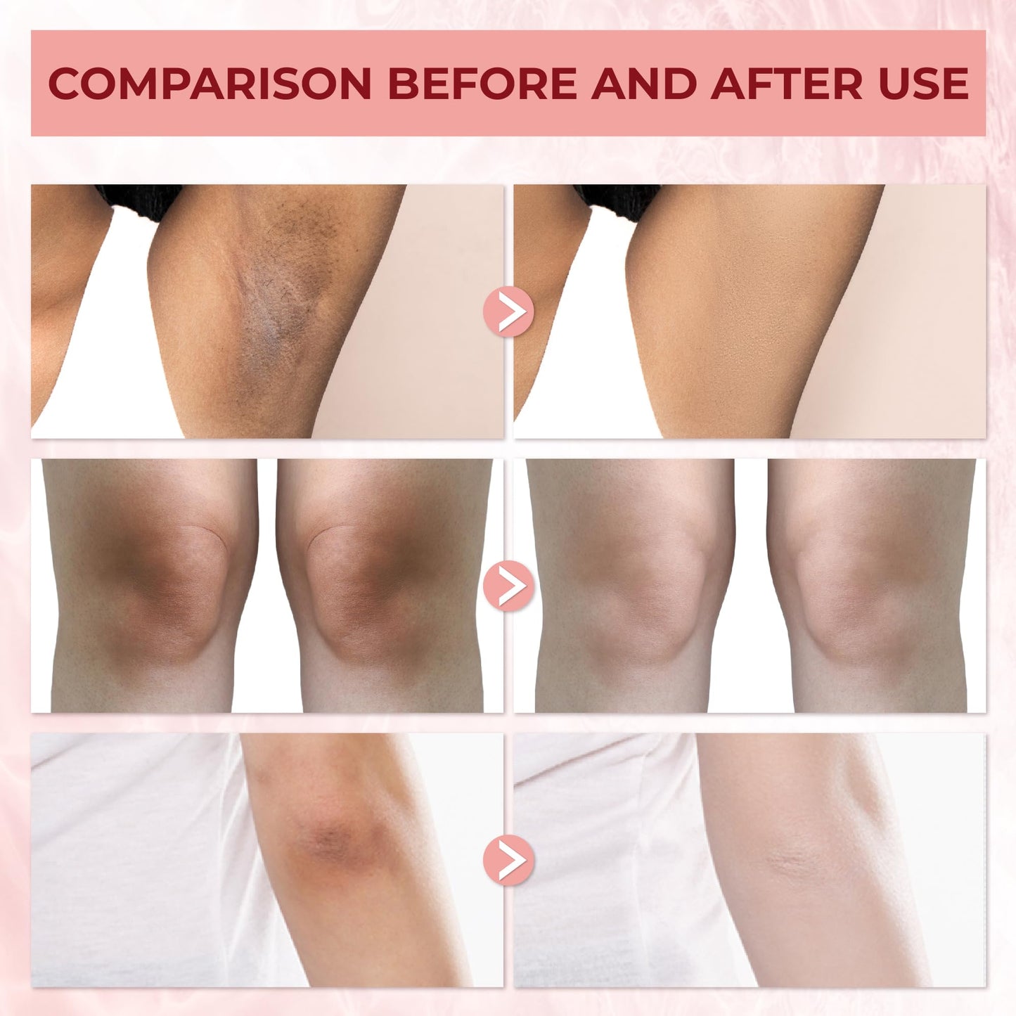 Abera Underarm Dark Spot Corrector Cream with Bearberry Extract, Targeted Armpit Spot Reducer & Sensitive Area Skin Tone Enhancer, Natural Even Tone Solution with Arbutin & Niacinamide