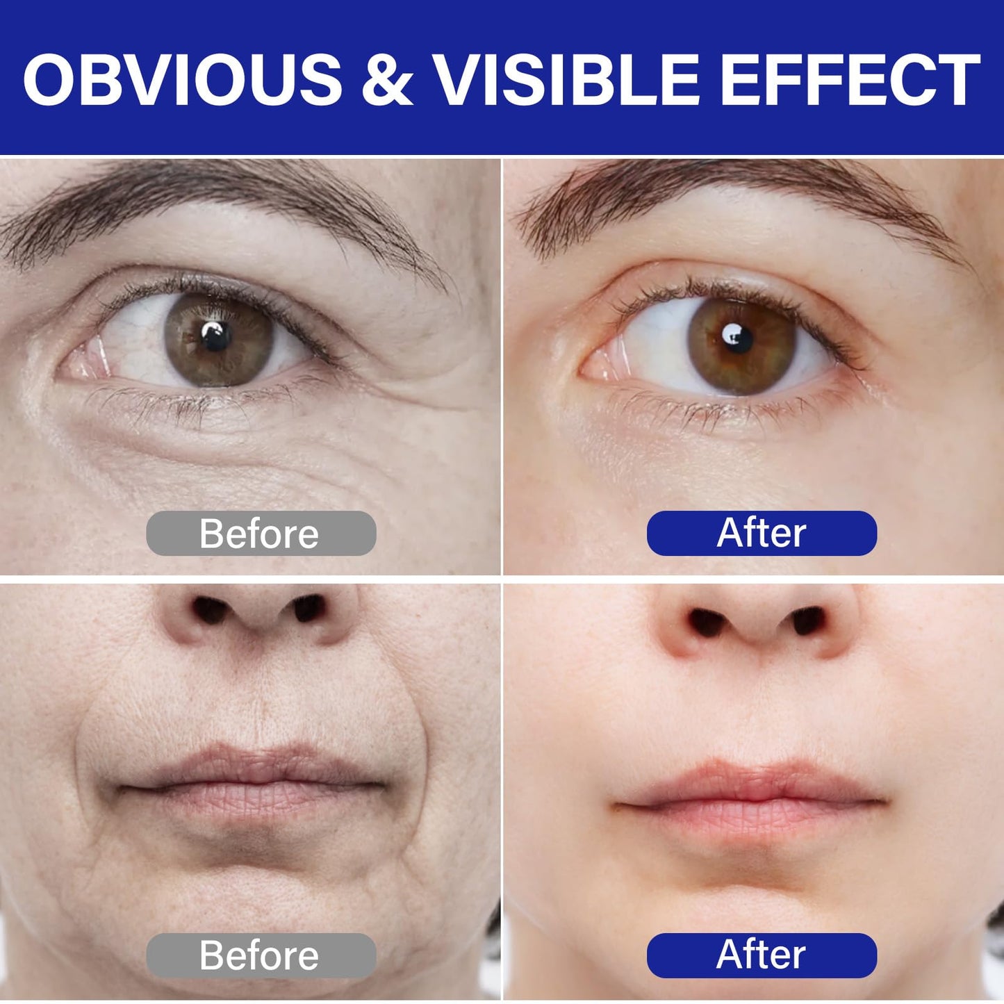 PDRN Serum丨Lifts and firms, Reduces Wrinkles, Deeply Moisturizes丨Peptides, PDRN丨Anti-aging, Improves Dullness