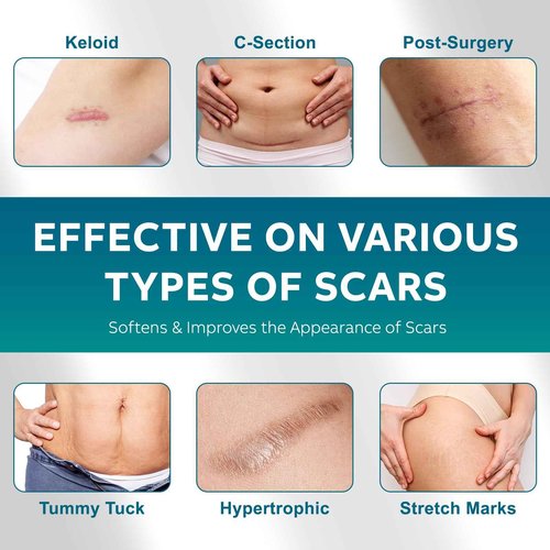 Silicone Scar Sheets, Silicone Scar Tape(1.6"x 120" Roll - 3 Meters) Scar Tape for Surgical Scars, Silicone Tape for Scars, Silicone Scar Strips for C-Section, Tummy Tuck, Keloid, and Surgical Scars