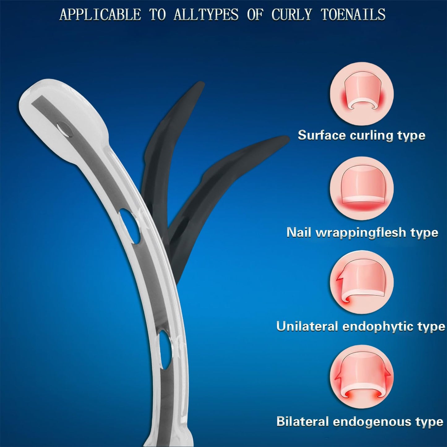 Titanium Alloy Ingrown Toenail Treatment for Curly Ingrown Toenail Corrector - Home Use arc Ingrown Toenail Removal Kit,Men, Women and Curled Toenail Corrector
