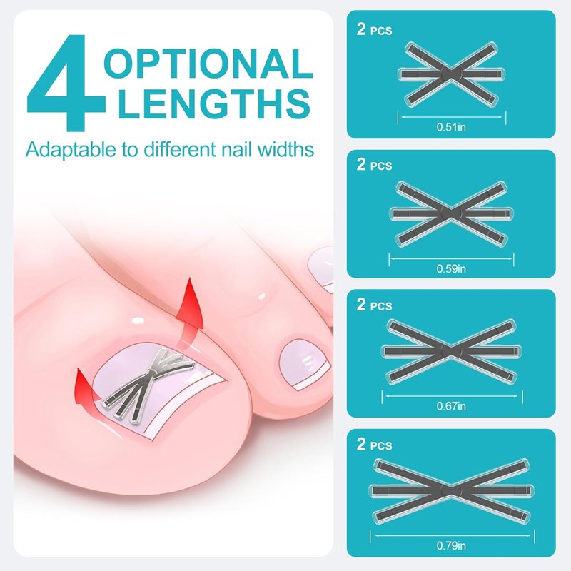Ingrown Toenail Treatment Kit - Titanium Alloy Nail Corrector Tools with 4 Sizes | 8-Piece Set for Quick Relief