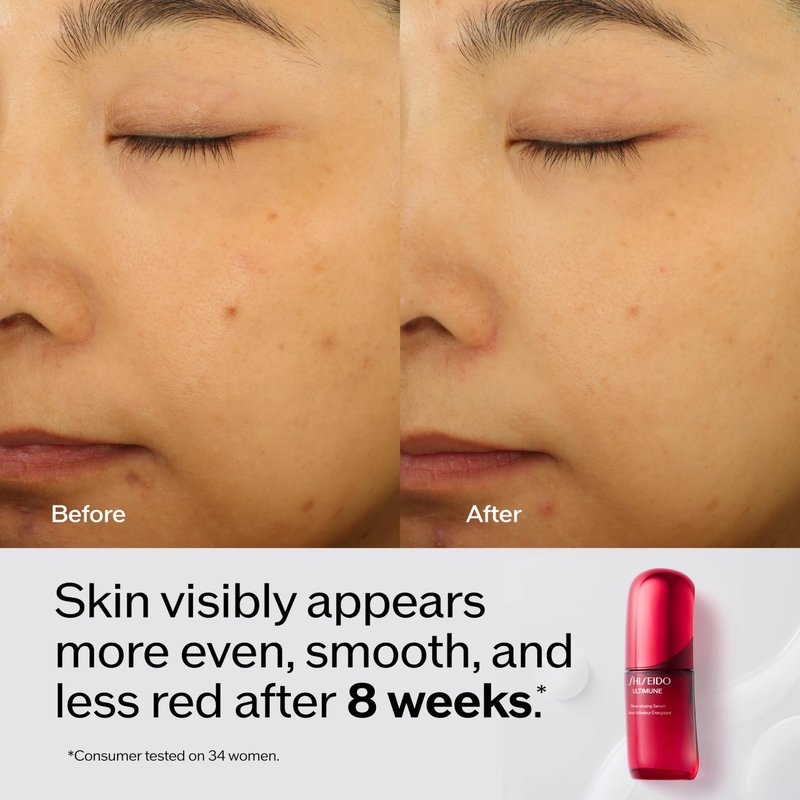 Shiseido Ultimune Power Infusing Serum - 2.5 oz - Breakthrough Lightweight Face Serum - Boosts Radiance & Improves Visible Signs of Aging - All Skin Types - Non-Comedogenic