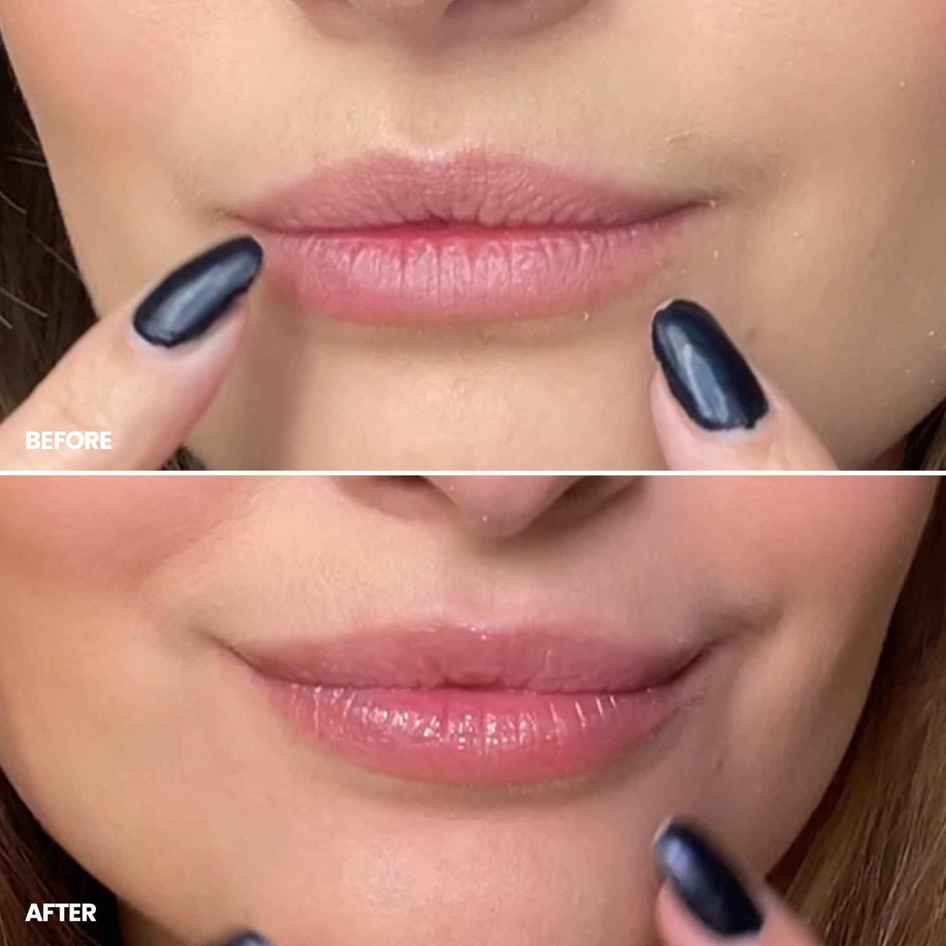 Wonderskin 3-in-1 Lip Scrub Exfoliator & Moisturizer, Lip Exfoliator Scrub, Hydrating Balm for Soft, Nourished, Flake-Free Lips with One-Step Prep, 0.10oz