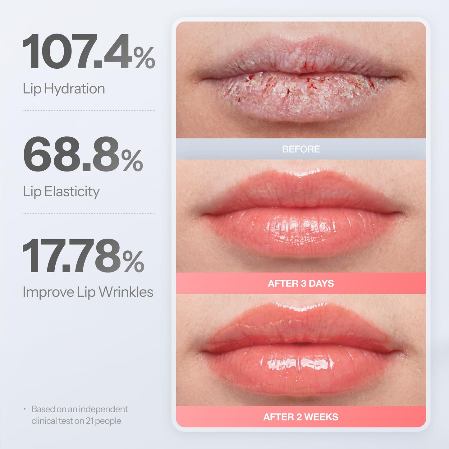 Dr.Different Retinal Lip Balm Tinted, Anti-Wrinkle Lip Treatment with Deep Hydration & Long-Lasting Moisture, K-Skincare made by Korean Dermatologist, 0.14oz