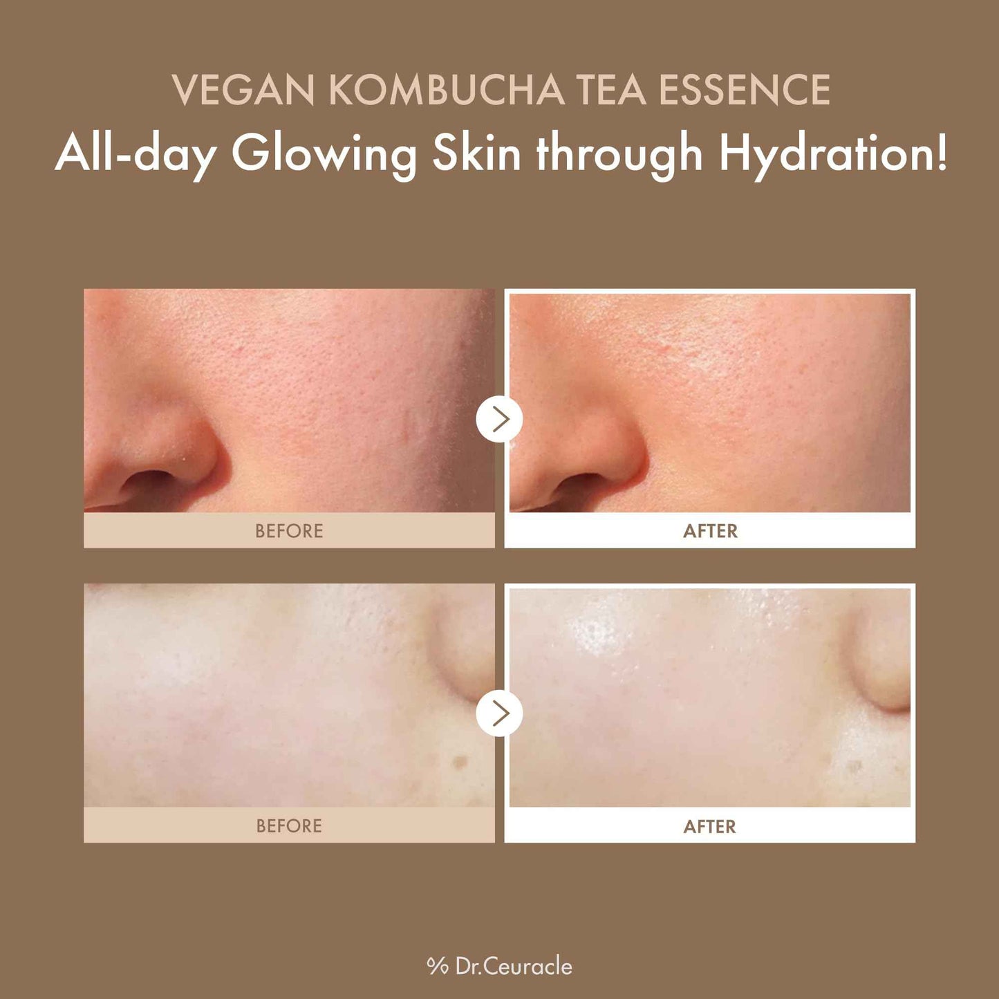 Dr.Ceuracle Vegan Kombucha Tea Essence - Hydrating Milky Toner with Kombucha Tea Extract, Centella Asiatica, Ceramide, Korean Skincare (150 ml / 5.07 fl. oz.)