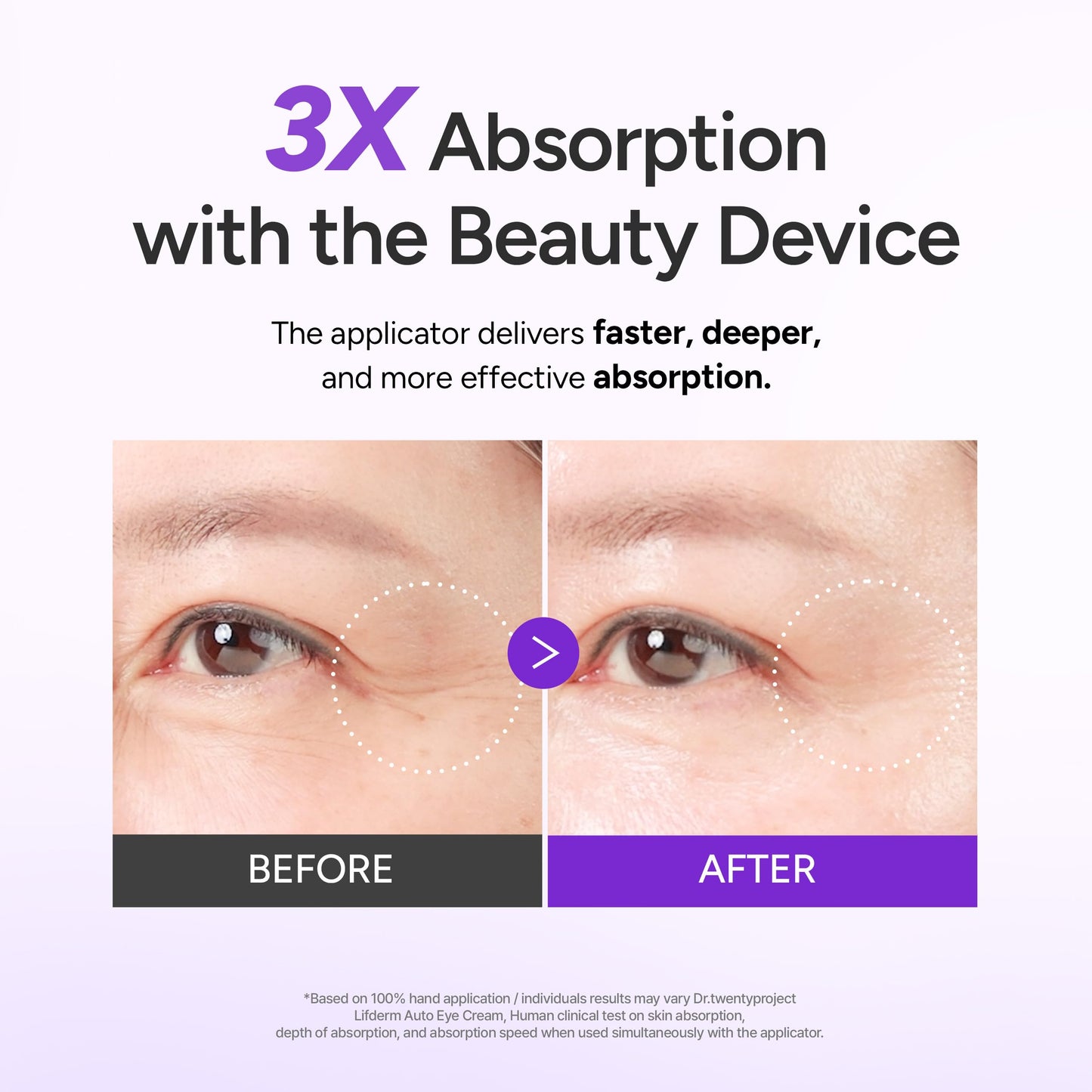Dr.twentyproject Lifderm Eye Cream with Collagen & Vibrating Device for Wrinkles, Anti-Aging, Dark Circles – Lifting, Firming, Tightening, Depuffing, Nourishing Korean Skincare (20ml 0.6 fl oz)