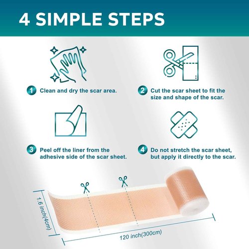 Silicone Scar Sheets, Silicone Scar Tape(1.6"x 120" Roll - 3 Meters) Scar Tape for Surgical Scars, Silicone Tape for Scars, Silicone Scar Strips for C-Section, Tummy Tuck, Keloid, and Surgical Scars