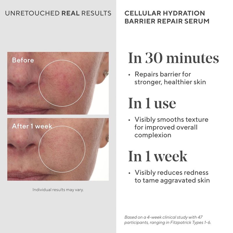 Murad Hydrate Trial Kit | Dewy Skin Set with AHA/BHA Cleanser, Hydration Serum, SPF 50 Moisturizer | Travel-Friendly Skincare