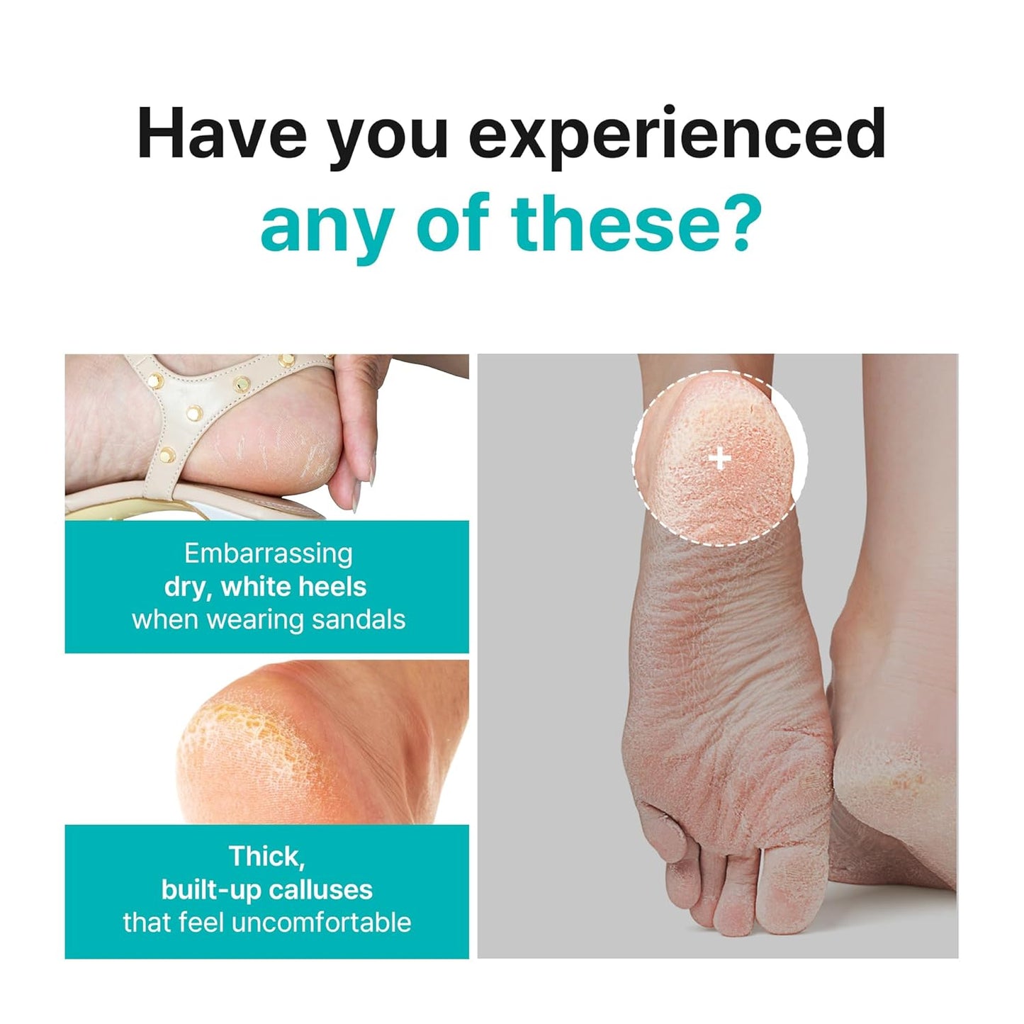 Ariul Foot Peel Mask | Calming Exfoliating Socks for Sensitive Skin - 2 Pairs (Tea Tree)