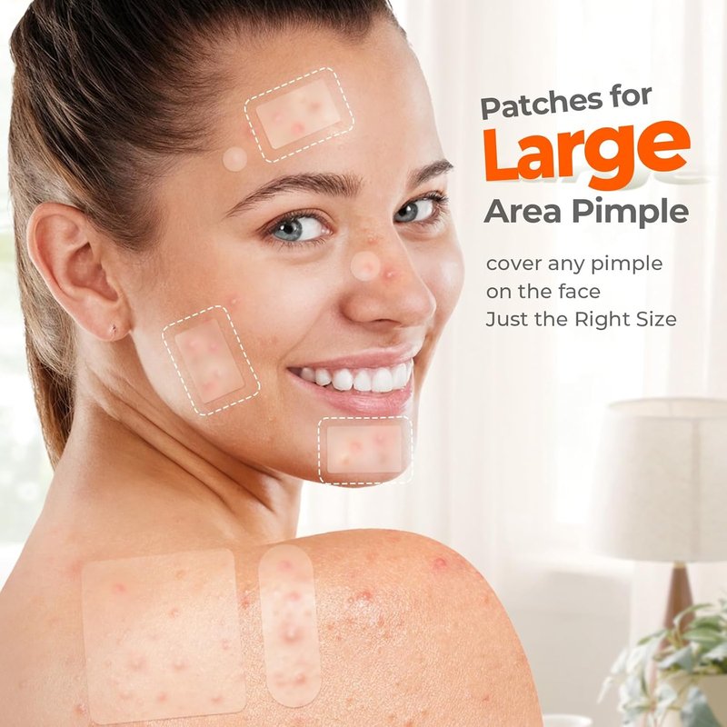 Large Pimple Patches - XL Hydrocolloid Acne Bandages for Face & Body | 142 Count, 7 Sizes