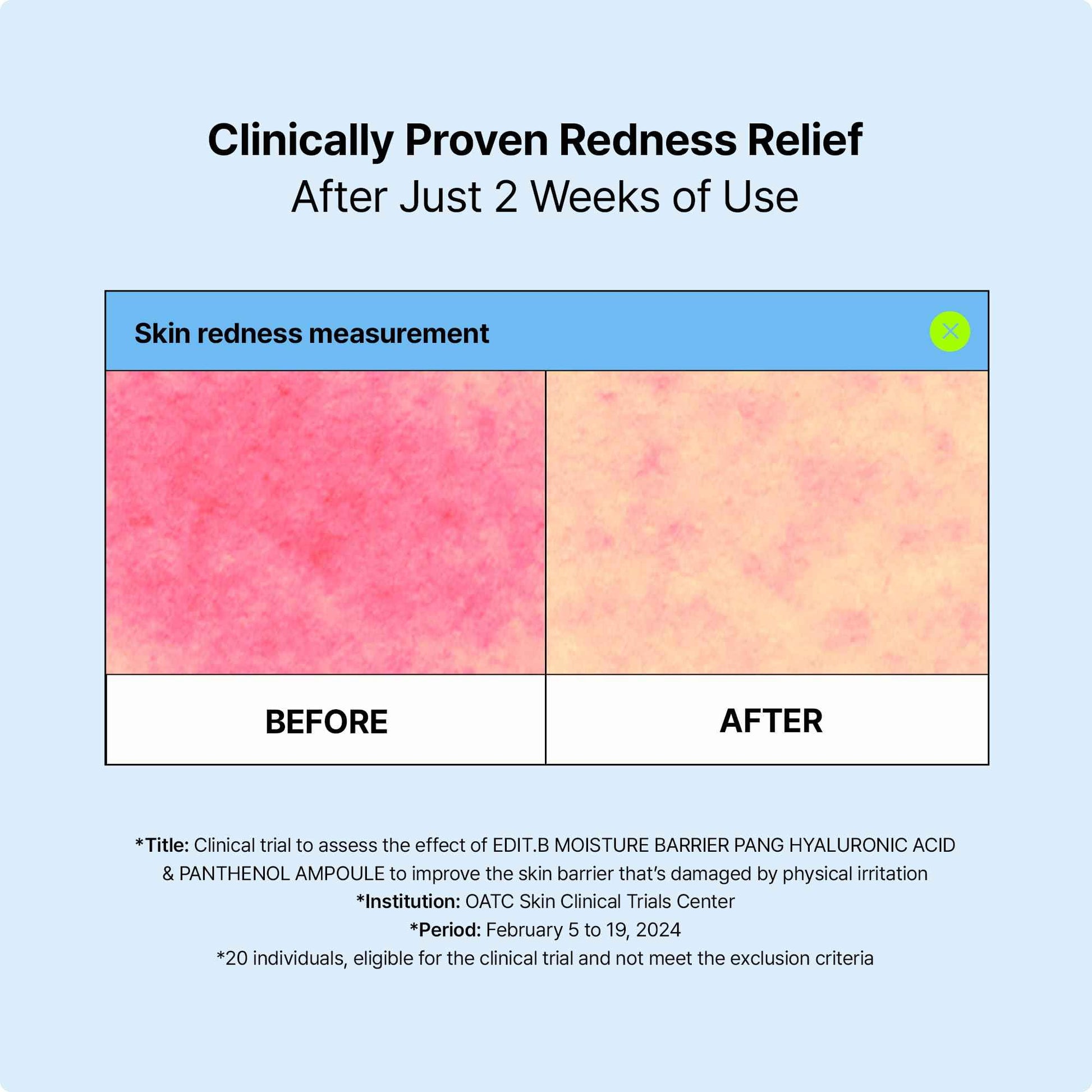 EDIT.B Moisture Barrier Pang Hyaluronic Acid Panthenol Ampoule, Long-Lasting Deep Hydration Lightweight Facial Moisturizing Serum, Soothing and Hydrating, Korean Daily Skin Care, 3.38 fl.oz (100ml)