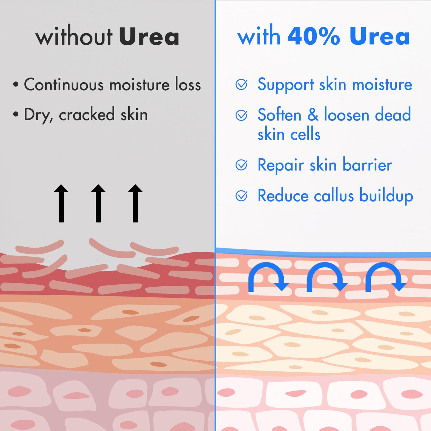 Ebanel Urea Cream 40% plus Salicylic Acid 2%, Foot Cream for Dry Cracked Heels Feet Knees Elbows Hands, Foot Dead Skin Cuticle Callus Remover Toenail Softener, Keratolytic Skin Barrier Repair Cream