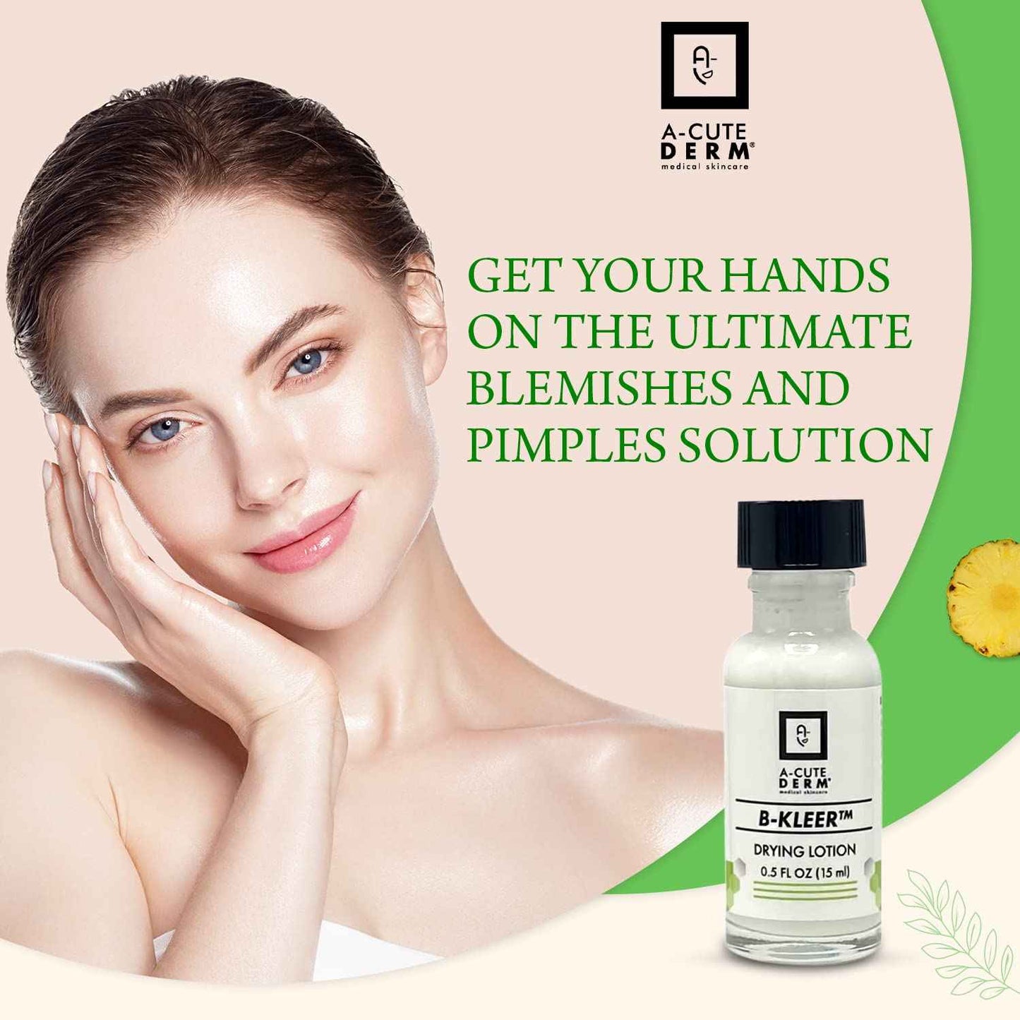 A-Cute Derm B-Kleer Drying Lotion Advanced Blemish Spot Treatment for Pimples, Razor Bumps & Oily T-Zone Fast-Acting Overnight Formula, Use Day or Night 0.5 oz