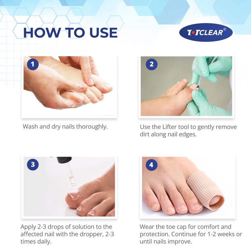 Ingrown Toenail Relief Tool - Effective Ingrown Toenail Removal Kit for Men & Women | 30ml