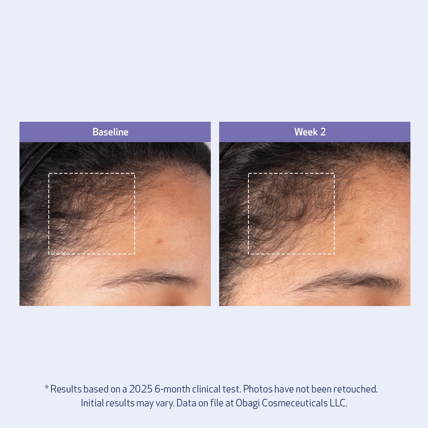 Obagi Nu-Cil BioStim Hair Scalp Serum with Biotin – Clinically Proven to Promote Scalp Health & Deliver Visibly Fuller, Denser Hair – Lightweight, Strengthens Follicles, & Encourages Regrowth – 2 oz