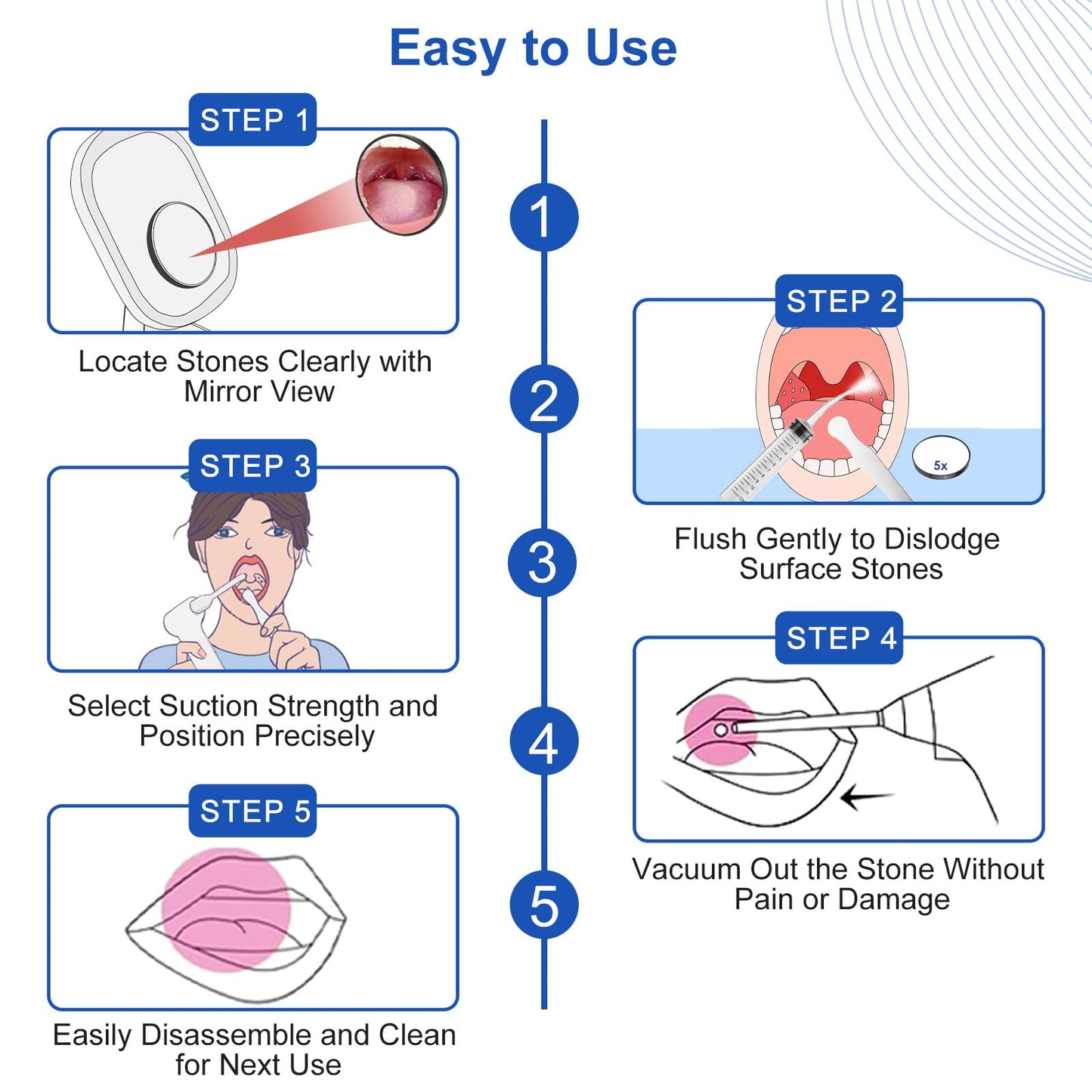 Tonsil Stone Vacuum Remover with LED Light Upgraded Electronic Oral Care Cleaning Tool Set 6 Suction Levels for Fresh Breath & Comfortable Use (White)