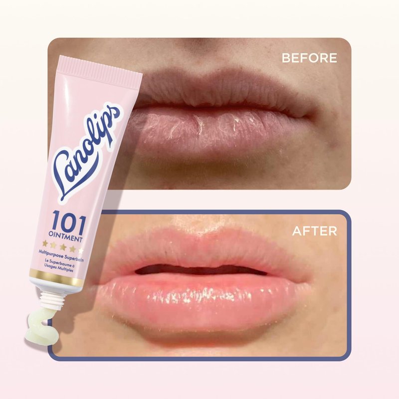 Lanolips 101 Multipurpose Ointment Duo - Lanolin Lip Balm & Healing Ointment for Skin Barrier Repair - Moisturizer for Dry Lips, Cuticles & Elbows - Original Superbalm (2-Pack, 0.52 oz each)