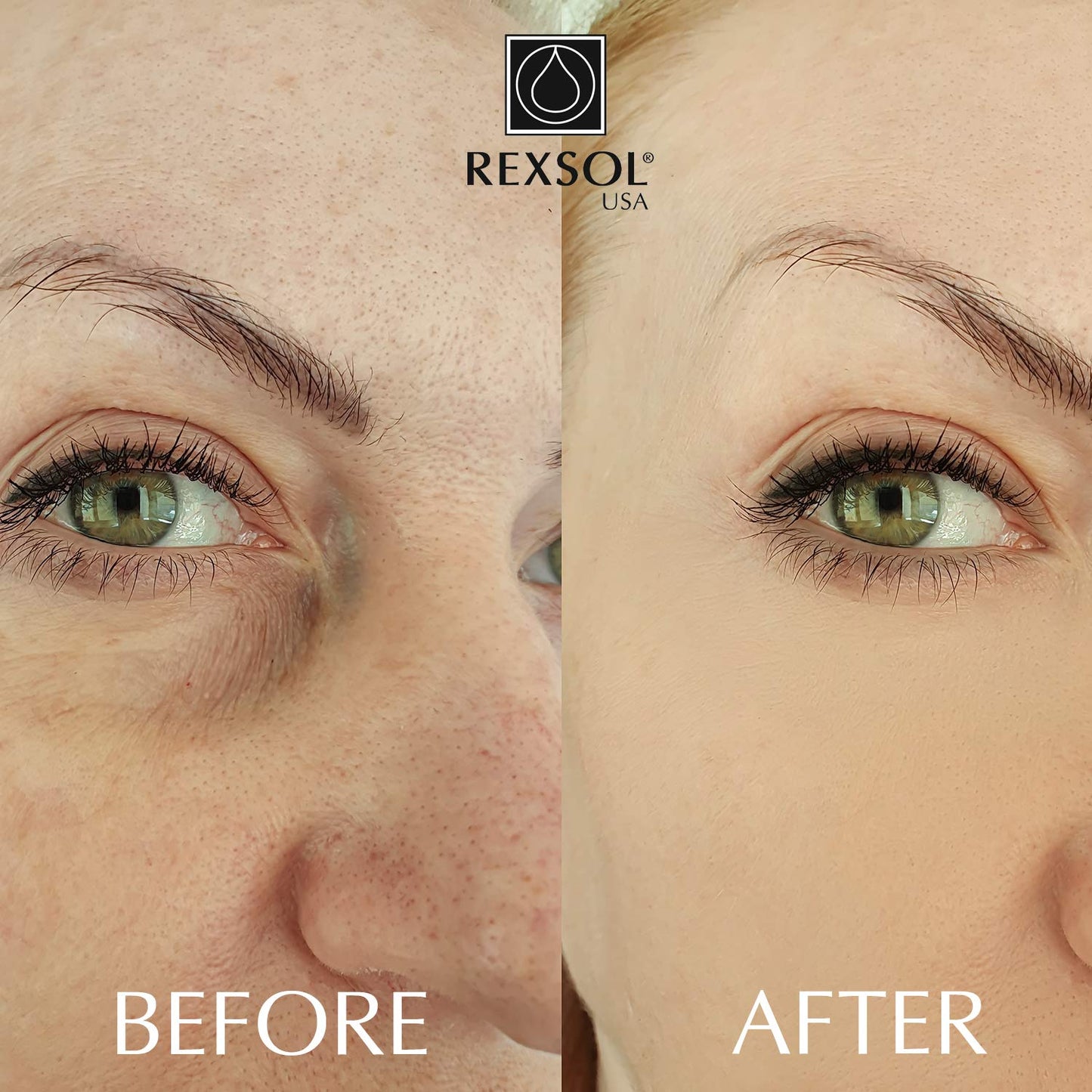 REXSOL Retinol + Vitamin C Anti-Aging Cream - Night Face Care & Dark Spot Remover | 2 OZ Infused with Vitamin E & A