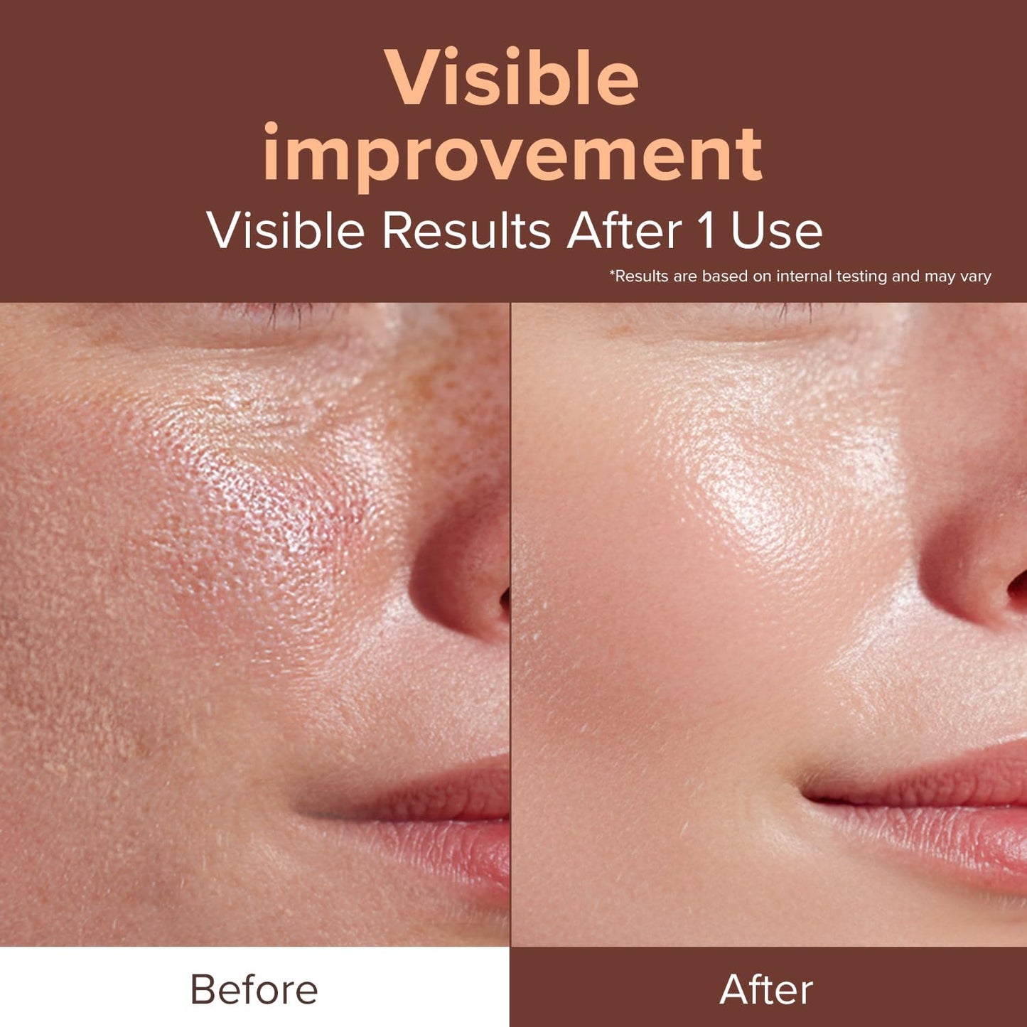 idplacosmetics EXO-V Booster Ampoule 1.01 fl.oz (30ml) – Exosome Serum (720,000 PPM) with PDRN & Glutathione, Korean Skincare Microneedling Serum, for Smoother-Looking Texture & Elasticity Support.