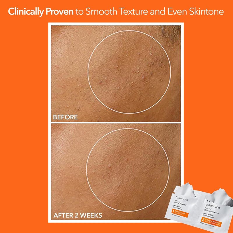 Dr. Dennis Gross Alpha Beta Daily Peel - Universal Treatment for Uneven Skin Tone & Fine Lines | 5 Treatments