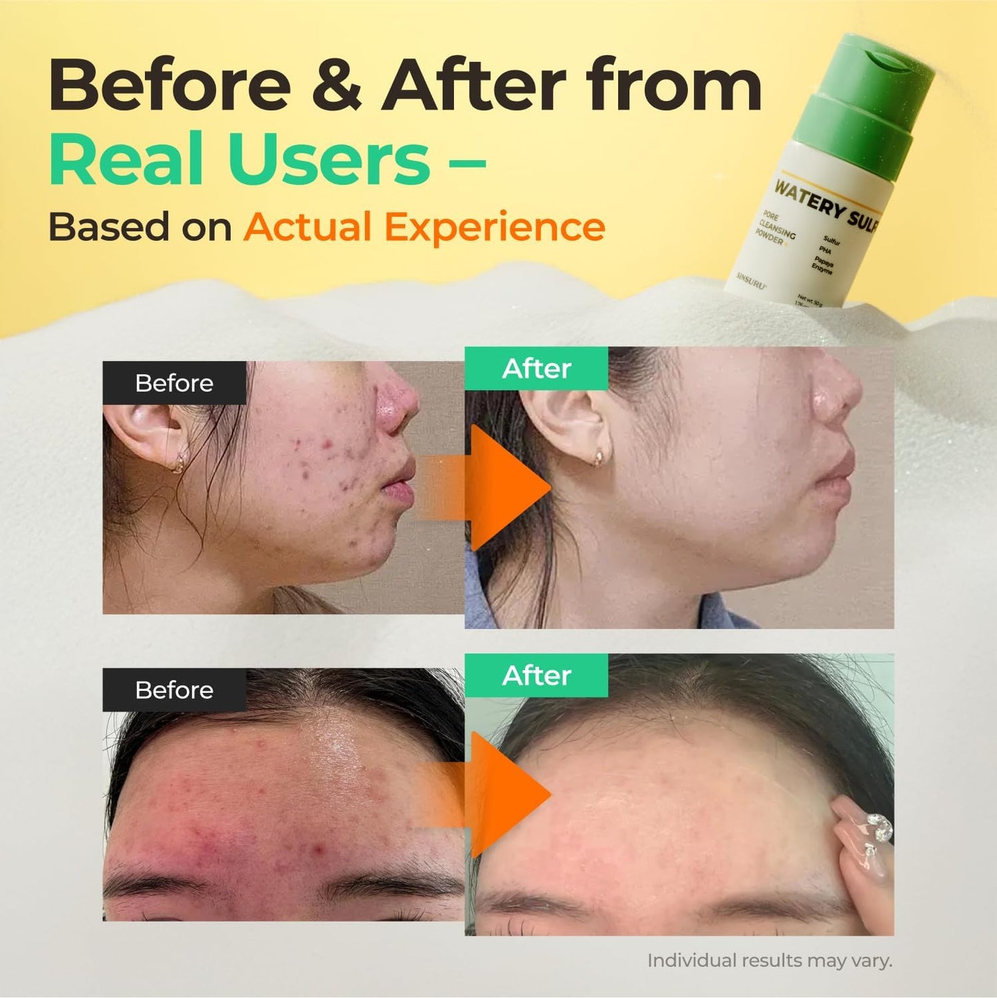 SINSURU Watery Sulfur Pore Cleansing Powder - Korean Sulfur Face Wash & Enzyme Face Wash with PHA | Deep Pore Cleansing & Oil Control for Oily, Sensitive Skin (1.76 oz / 50g)
