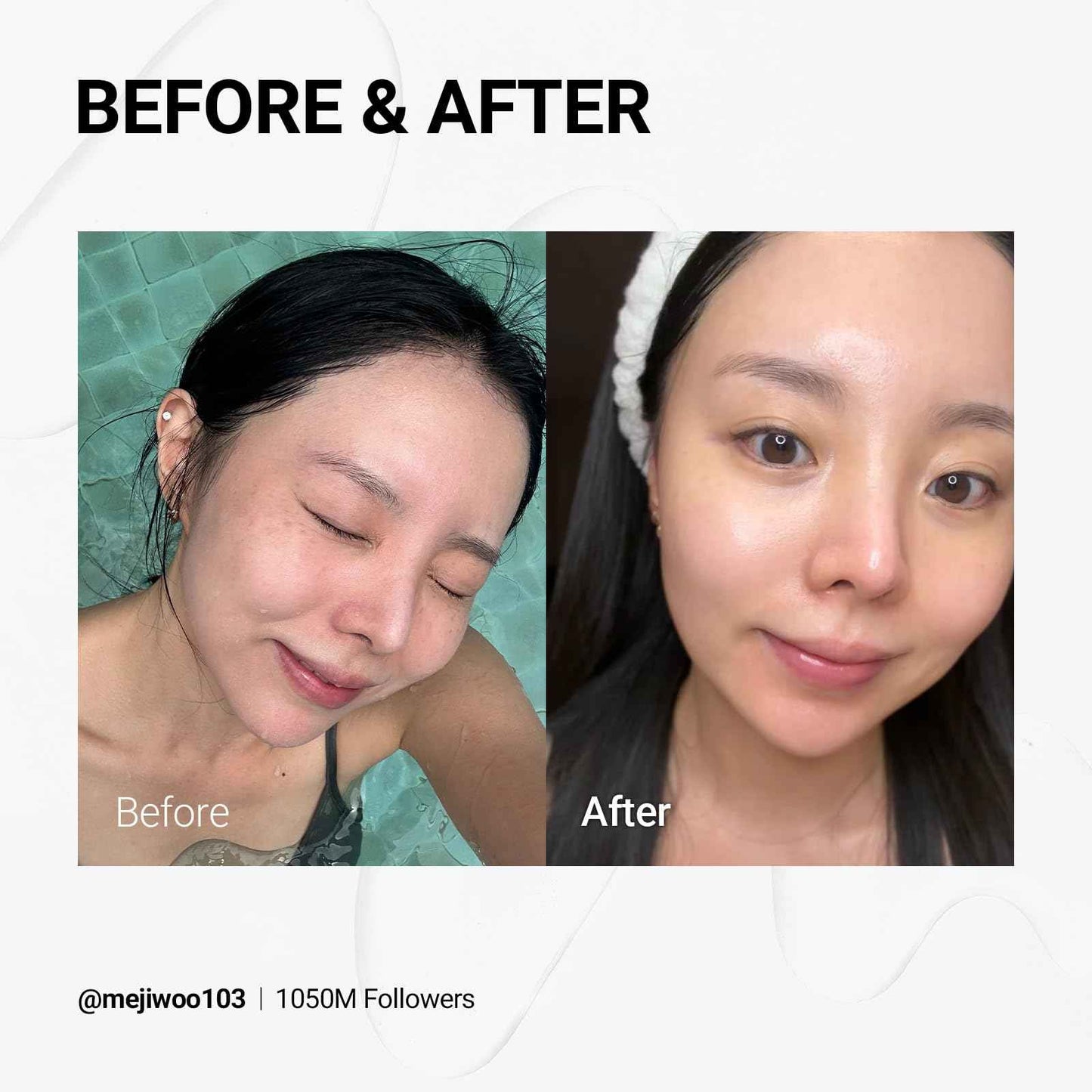 NEAF NEAF Vita PDRN Ampoule, A 30-day ampoule with Licorice PDRN and Vitamin C to improve skin spots and radiance. (20ml /0.68 oz)