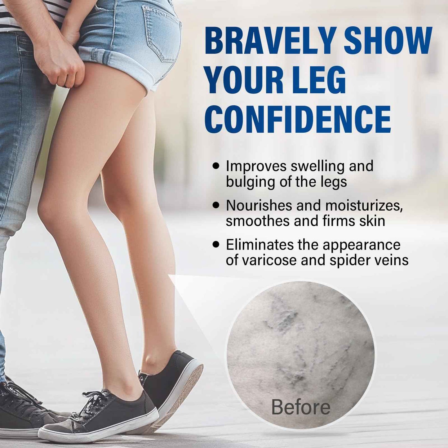 Josera Varicose Veins Treatment for Legs, 2 Count Varicose Veins Cream - Improves Blood Circulation and Reduces Heaviness