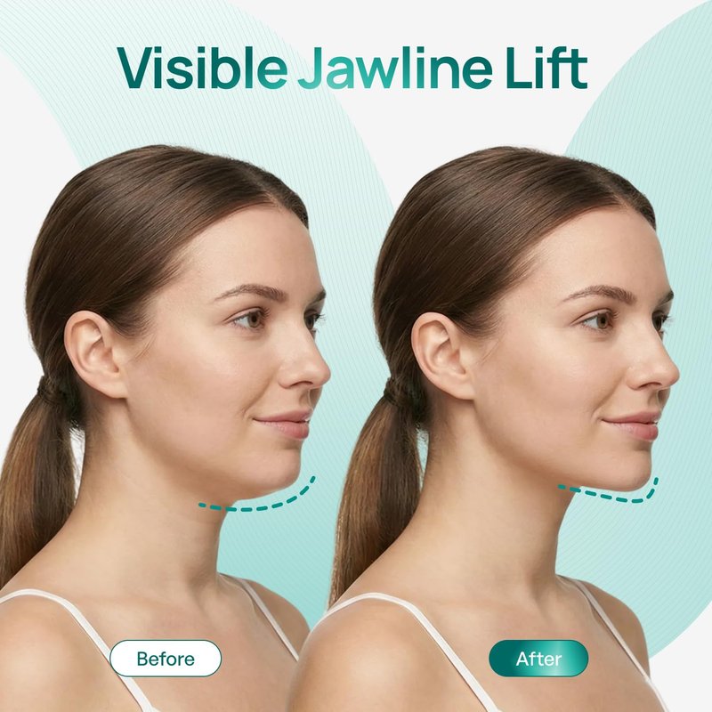 PLANTIFIQUE V-Line Chin Lifting Mask, 15 PCS - Double Chin Strap with Hyaluronic Acid & Aloe Vera - Jawline Shaping, Neck Firming and Tightening