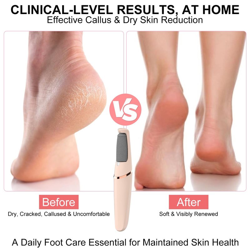 Electric Foot File, Callus Remover for Feet - Rechargeable Pedicure Tool, 2 Speeds 1700/2000 RPM & 2 Heads for Dry & Dead Cracked Skin, Cordless Waterproof Hard Skin Removal, Home Pedicure Gift