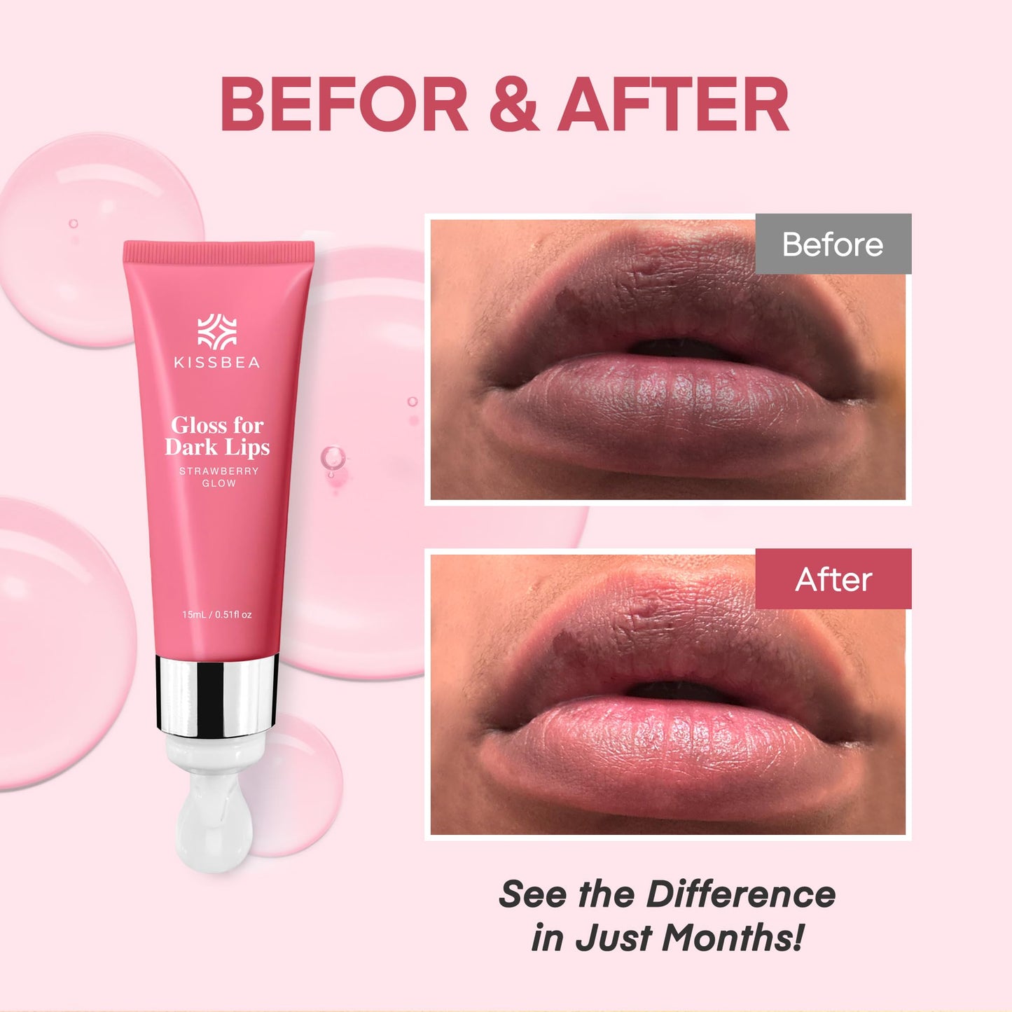 KissBea Lip Lightening for Dark Lips: for Smokers, Dry or Uneven-Toned Lips – Restores Natural Look & Moisture with VC, Lemon Peel & Licorice – Refreshing Strawberry Scent – 15 mL