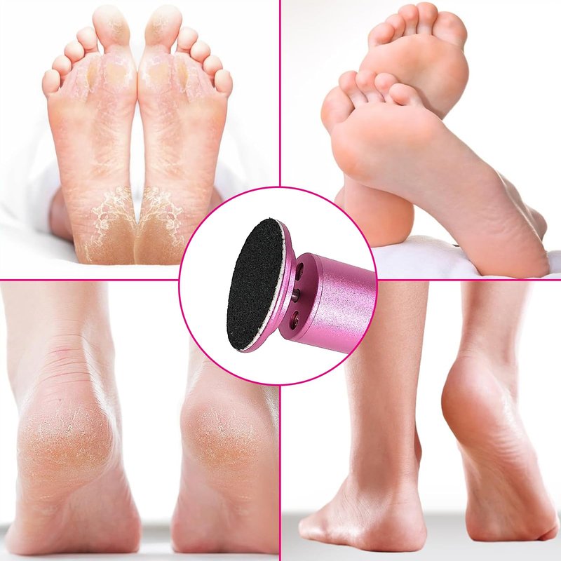 Electric Foot Callus Remover, Adjustable Foot Speed, Professional Foot Repair Tool, Equipped with 60 Pieces of Sandpaper, Suitable for Men and Women with Dead Skin calluses, Dry and Cracked, Pink