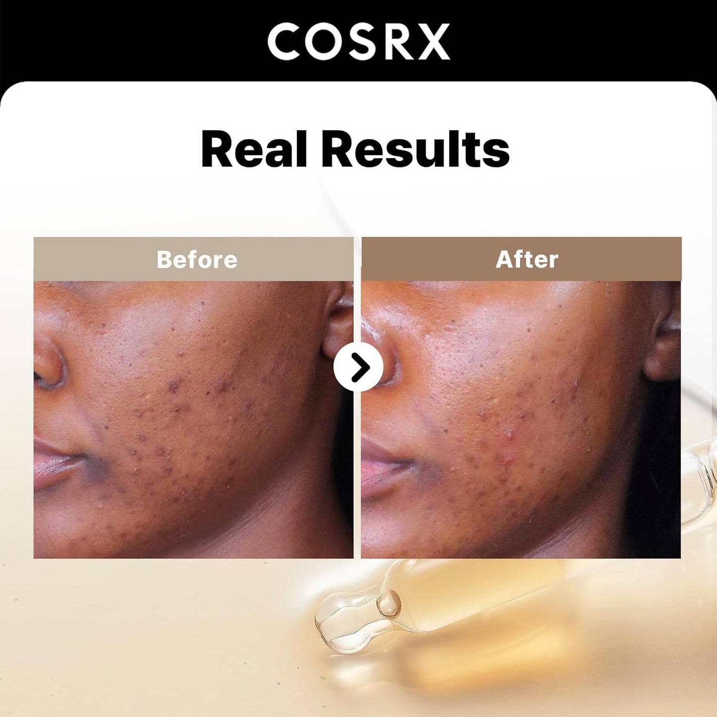 COSRX Vitamin E Face Sunscreen SPF 50 | Discoloration Care with 2% Alpha Arbutin