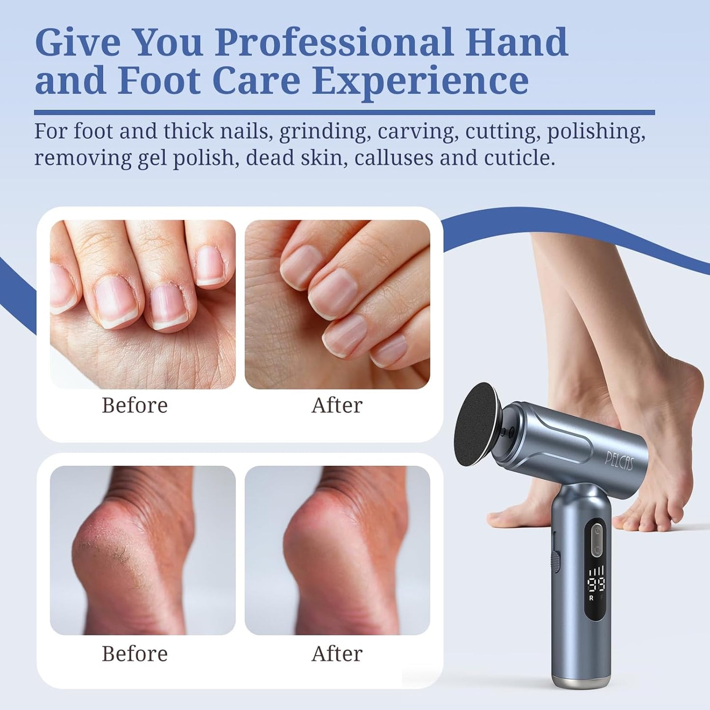 Electric Foot Callus Remover - Upgraded 2-in-1 Manicure & Pedicure Kit with LED Screen | Cordless Grey Filer for Thick Nails