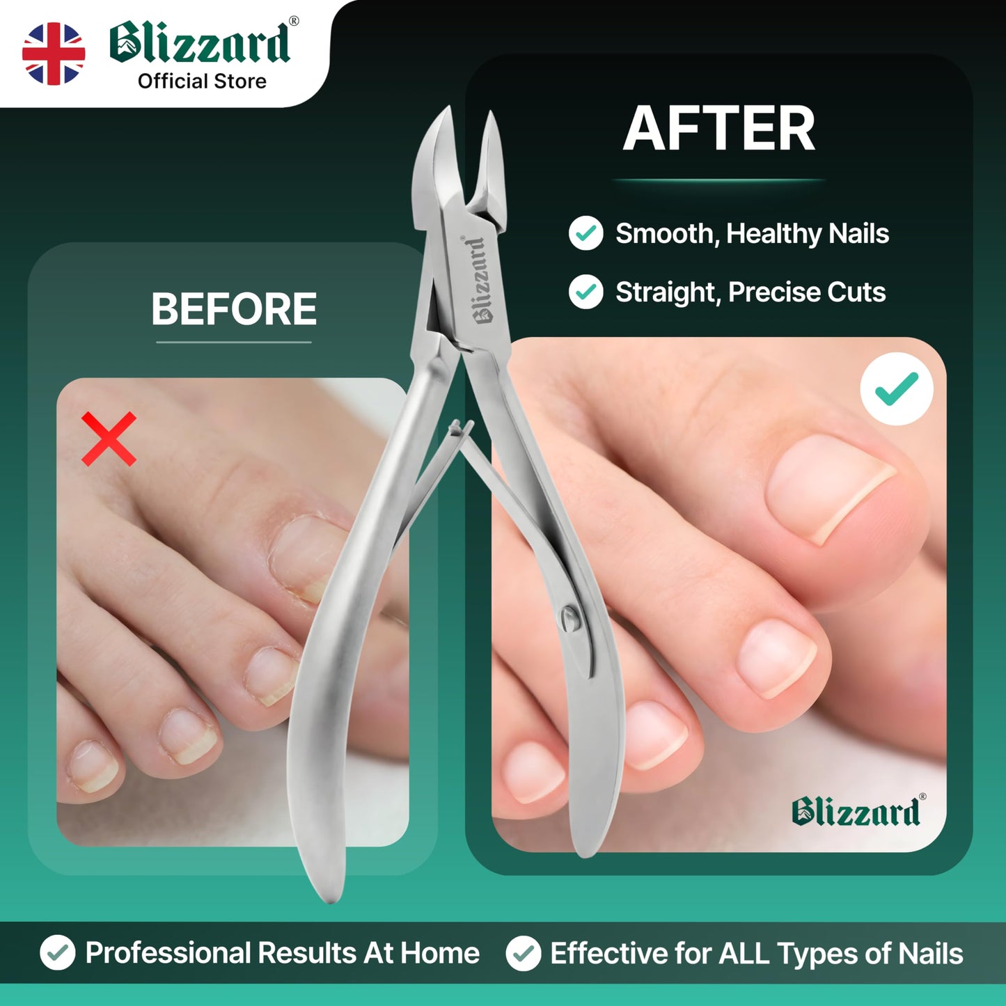 Blizzard Ingrown Toenail Clippers - Podiatrist Toenail Clippers for Thick Nails for Seniors - Ingrown Nippers for Men - German Steel Podiatry Tool with Toenail File - 13cm Concave Head