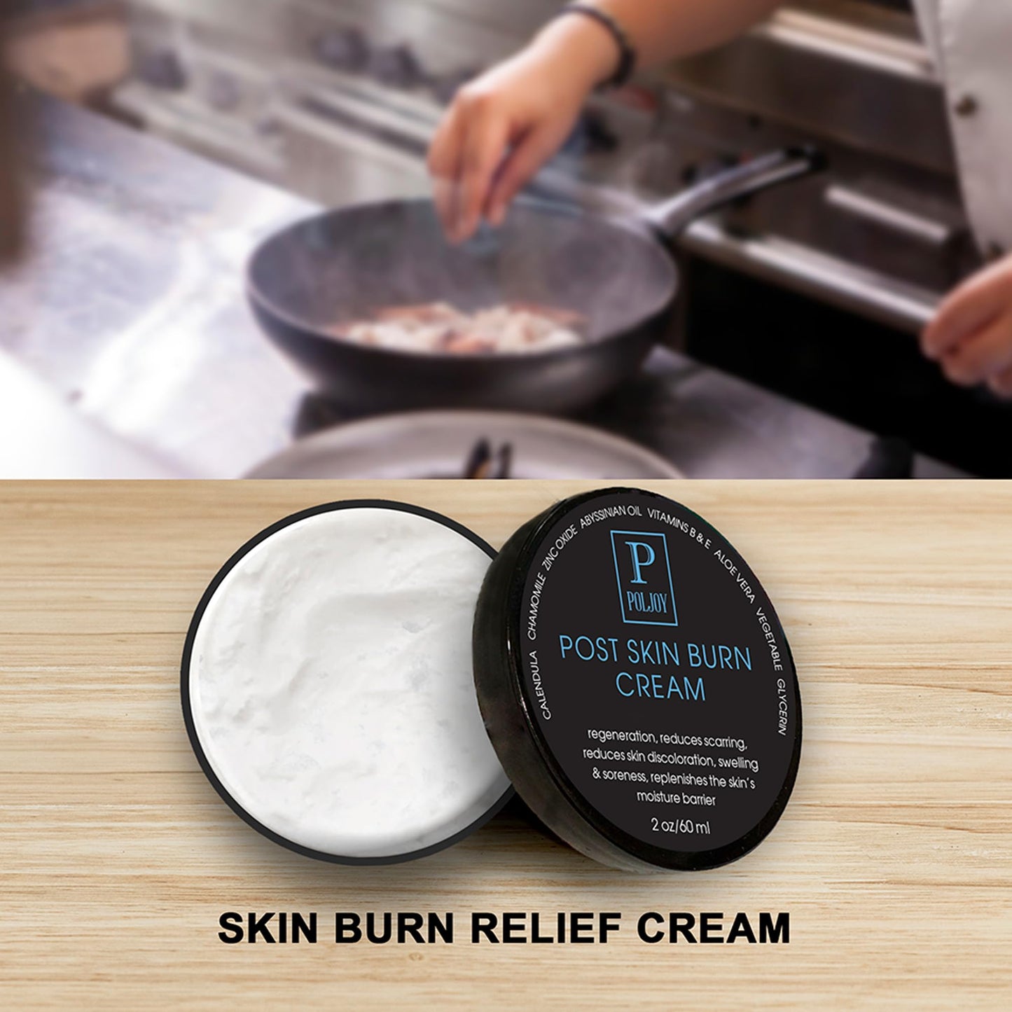 PolJoy Post Skin Burn Cream, Sunburn Cream for First Aid Treatment, Hydrates & Repairs Skin with Aloe Vera, Shea Butter, Zinc Oxide, Calendula, Coconut Oil & Vitamins B&E, Kitchen & Travel Use