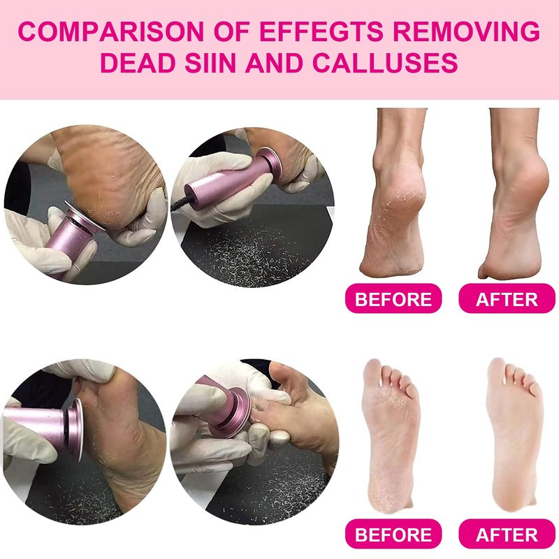 Electric Foot Callus Remover, Adjustable Foot Speed, Professional Foot Repair Tool, Equipped with 60 Pieces of Sandpaper, Suitable for Men and Women with Dead Skin calluses, Dry and Cracked, Pink