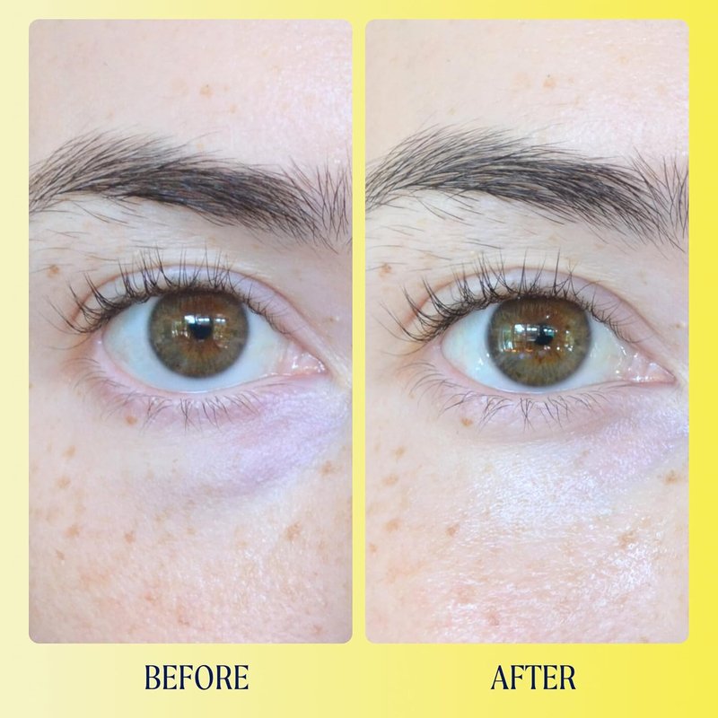 Brightwave Vitamin C Under Eye Brightener Cream - Dark Circles Treatment for Sensitive Skin | Hydrating Antioxidant Formula (0.5 Oz)