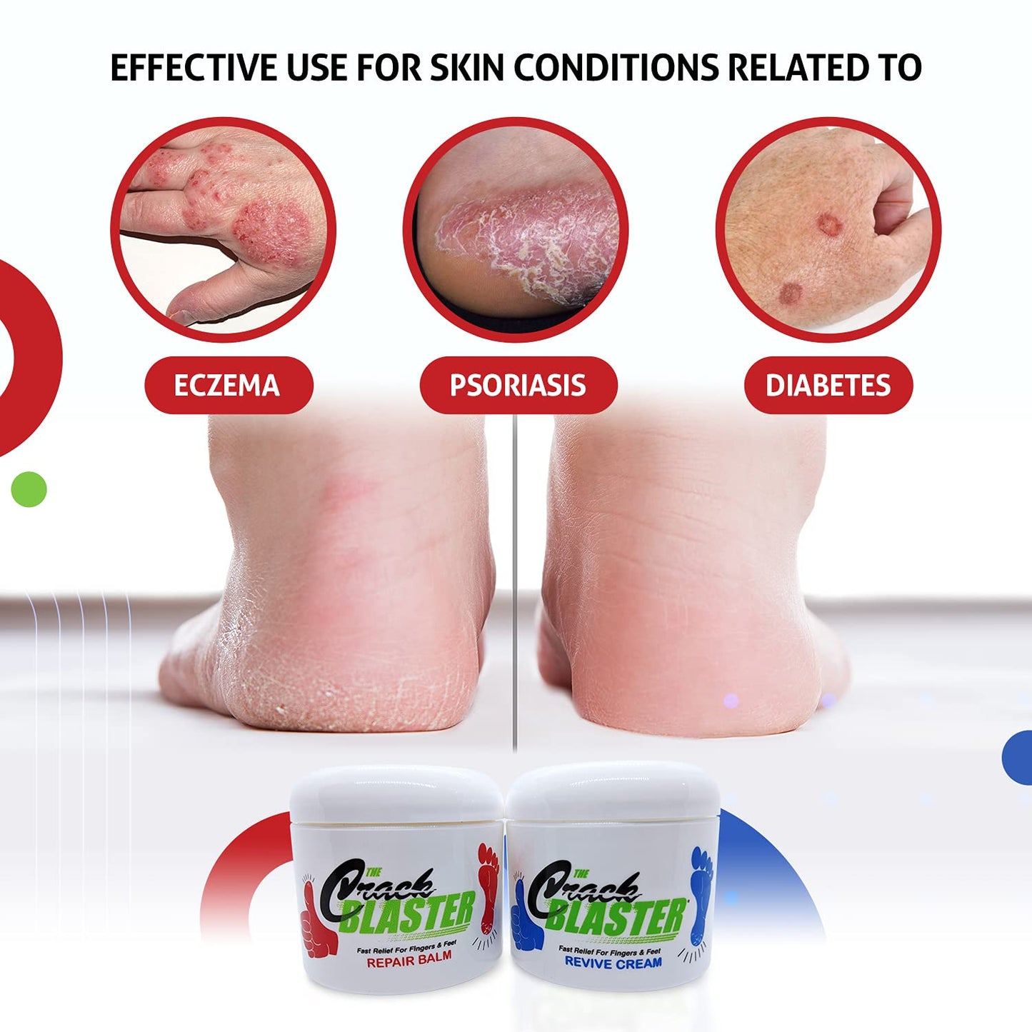 Crack Blaster Repair - Cracked Skin, Heel, Finger Healing Balm and Crack Blaster Revive Dry Skin and Body Cream