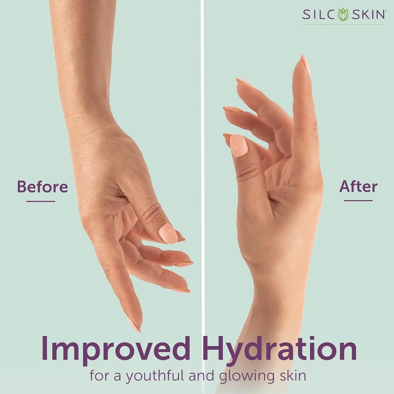 Silcskin Hand And Body Treatment Lotion - Water-Based Formula for Crepey Skin & Fine Lines | 4 Oz