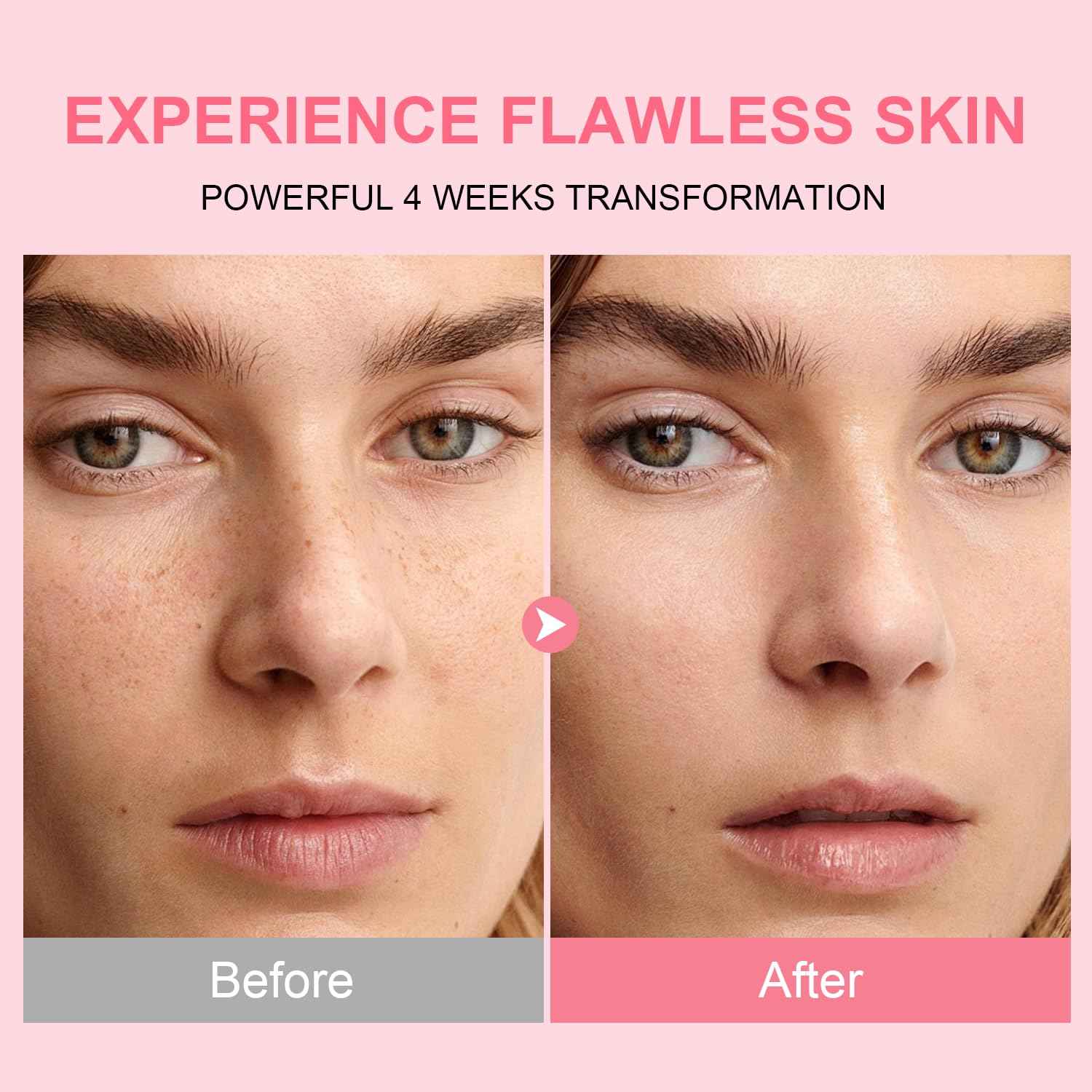 AVJONE Niacinamide 10 + TXA 4 Serum, Facial Serum for Glass Skin, Clarifying, Radiant Complexion with Natural Color - Vegan Paraben Fragrance Cruelty Free (30ml /1.01 fl.oz)